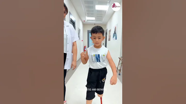 Little Hero’s First Steps with Prosthetic Legs | Unstoppable Willpower #nevergiveup #artificiallimb