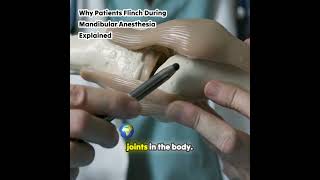 Why Patients Flinch During Mandibular Anesthesia Explained