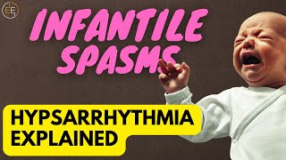 Hypsarrhythmia - What Is It? What Does It Mean? - Infantile Spasms