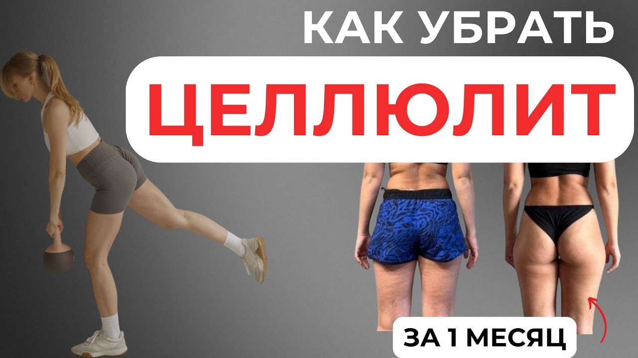 Как убрать ЦЕЛЛЮЛИТ - подробная инструкция