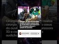 Cirurgião usa impressão 3D para restaurar audição 👂🧬