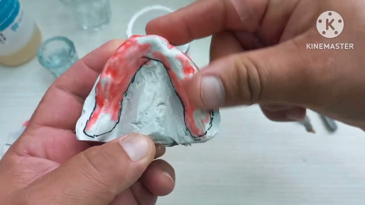 Prótese total/moldeira individual parte 01