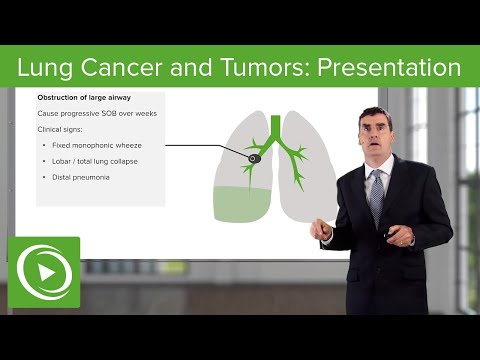 Video: Peripheral Lung Cancer: Symptoms And Treatment. Peripheral Cancer Of The Lobe Of The Lung: How To Treat