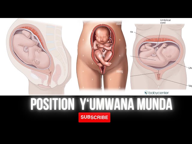 POZITION Y'UMWANA Munda y'umugore utwite, wakora iki ngo ubyare neza