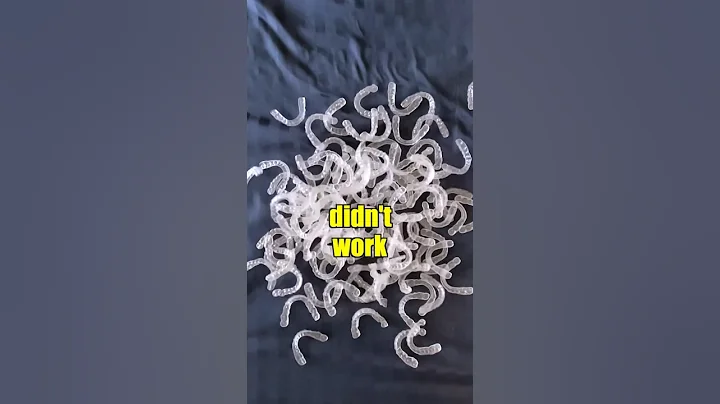 Invisalign Was A Disaster