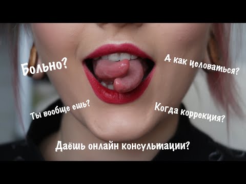 Видео: Почему у меня раздвоение языка?