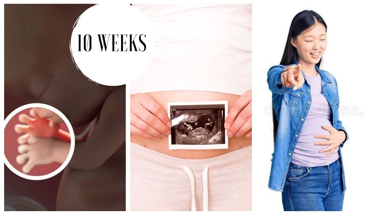 10 Week Pregnancy Everything You Need to Know! YouTube