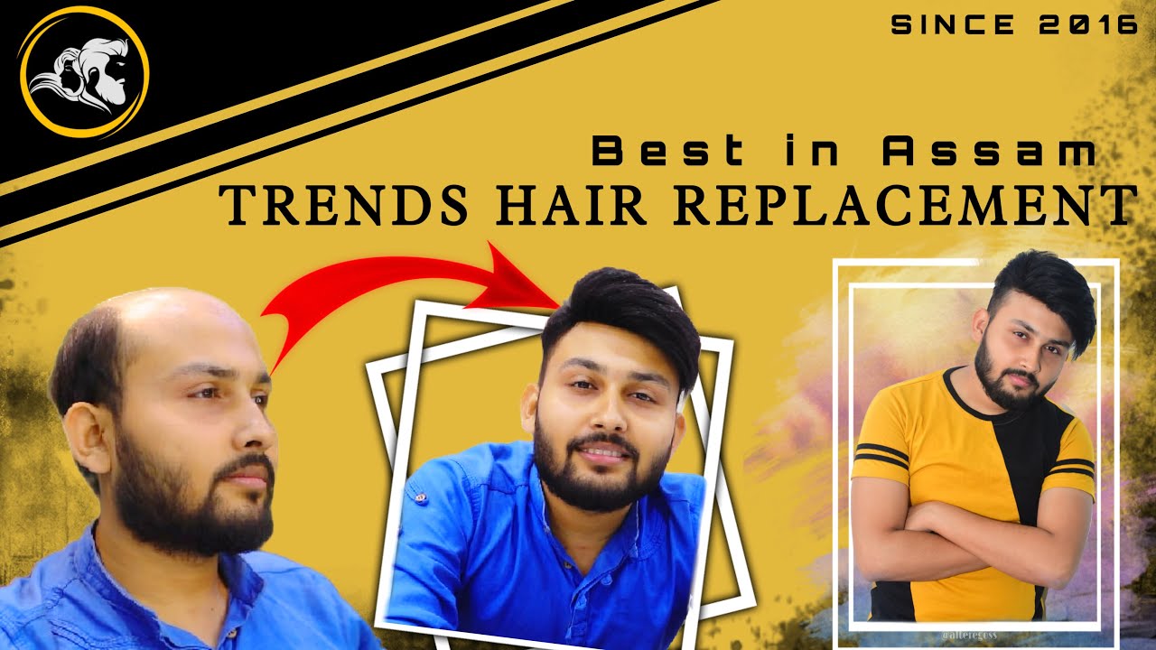 TRENDS HAIR REPLACEMENT | BEST HAIR PATCH in Guwahati | BEST HAIR WIG in ASSAM 
