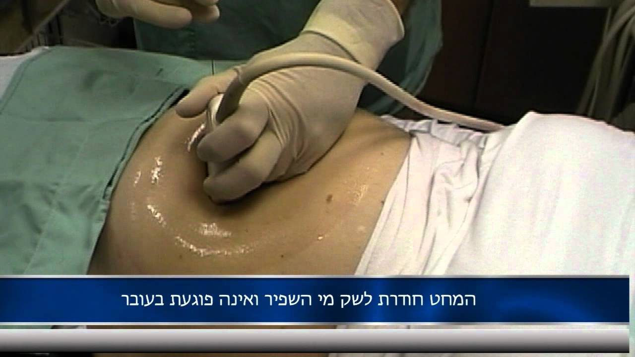 בדיקת מי שפיר בהיריון- ד