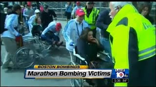 Amputee details recovery for bombing victims