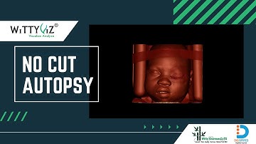 WittyViz No-Cut Autopsy (NCA) Features & Demonstration