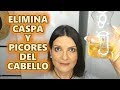 ELIMINA LA CASPA Y PICORES DEL CABELLO DANDO BRILLO Y VITALIDAD/MÁS DE CUARENTA