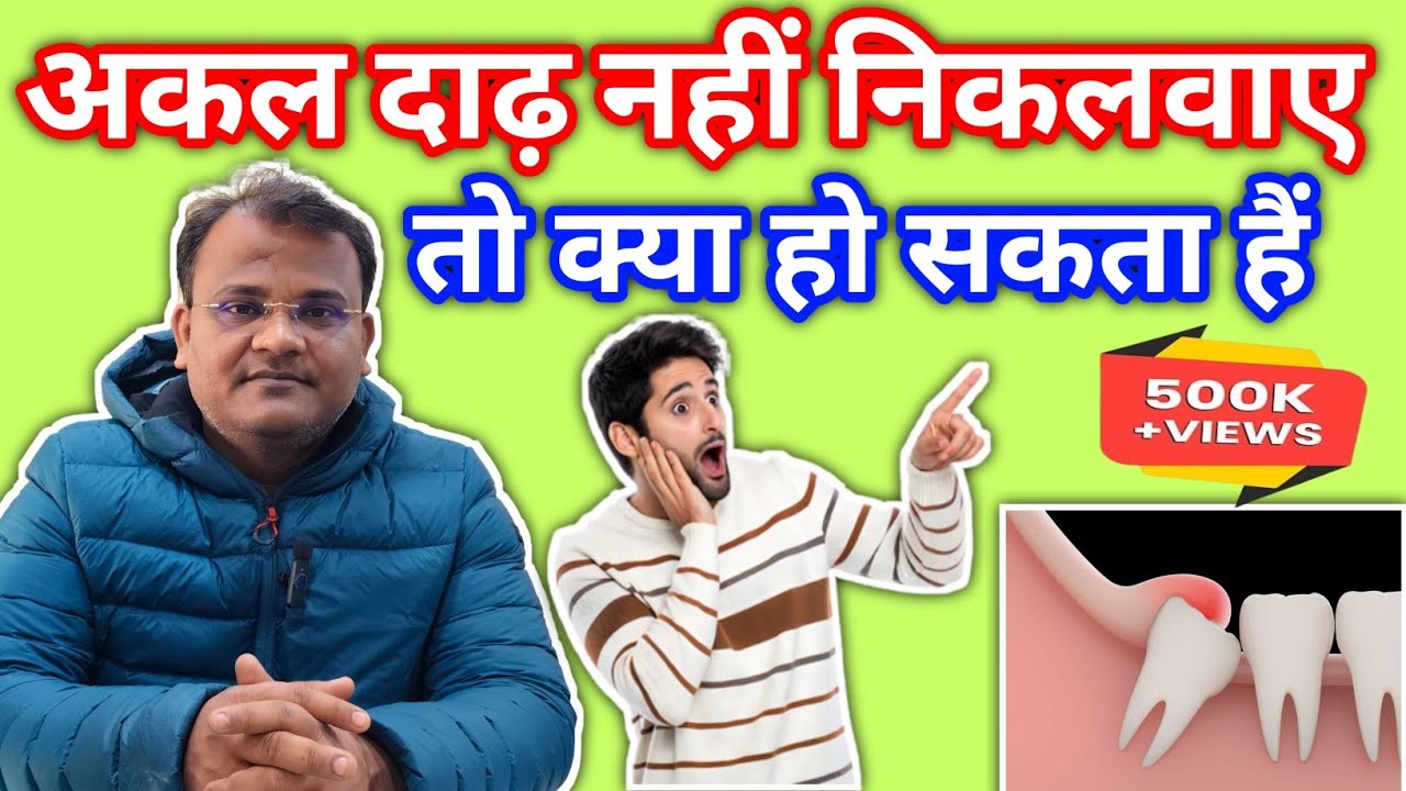 अकल दाढ़ नहीं निकलवाए तो क्या हो सकता है || जानिए || By Dr.S.P.Singh Banda || 