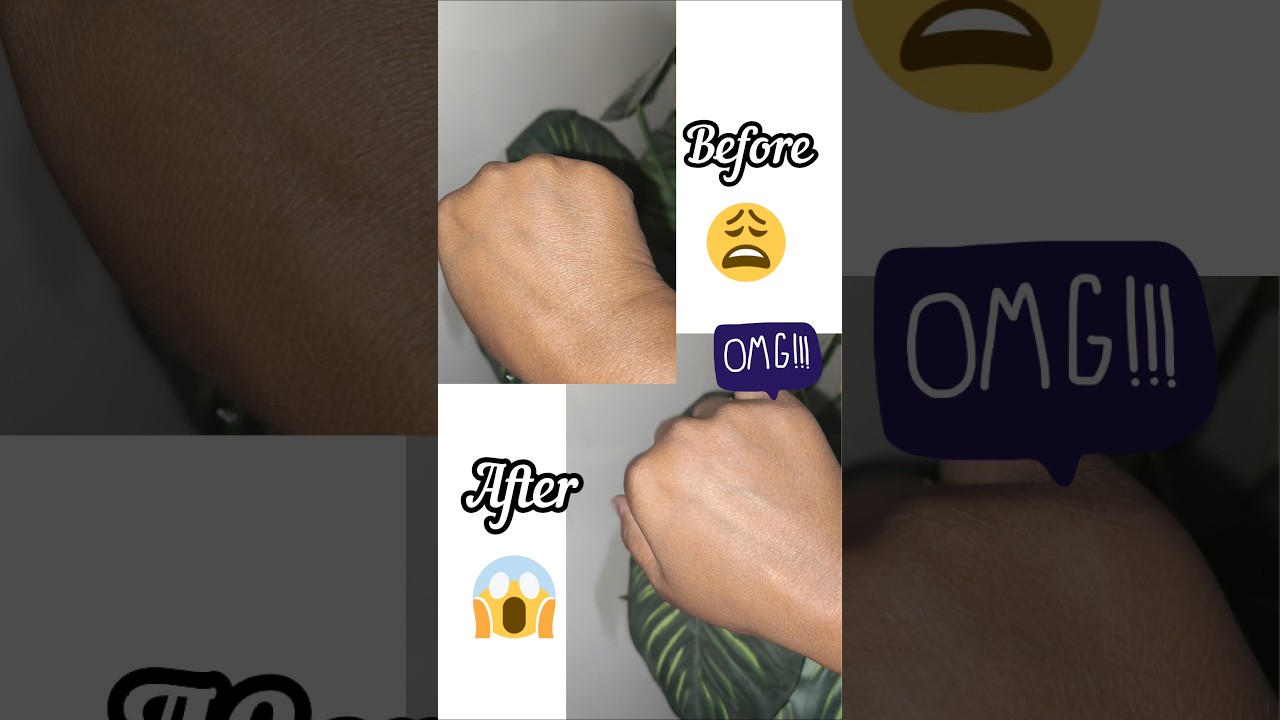 Sanfe Instant Tan Removal Gel honest review 