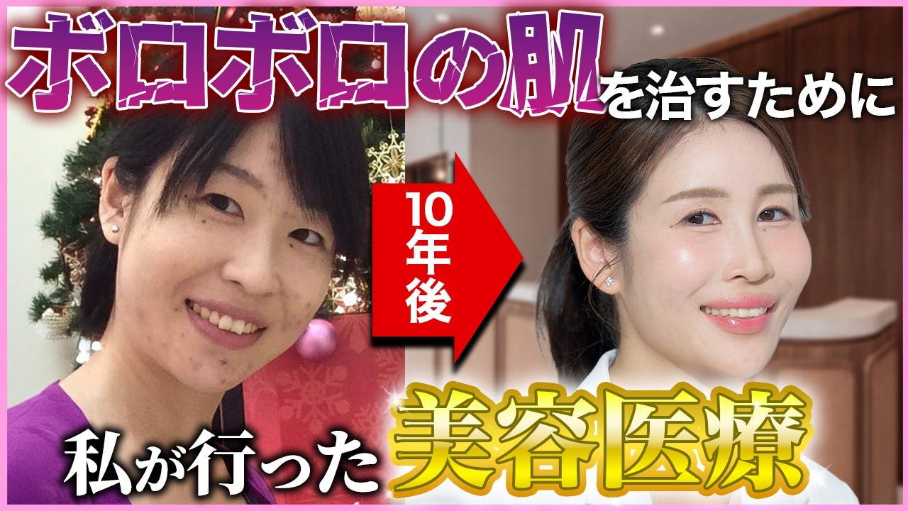 アラフォー女医の私が、ボロボロだった肌を「肌育注射」で立て直した全記録