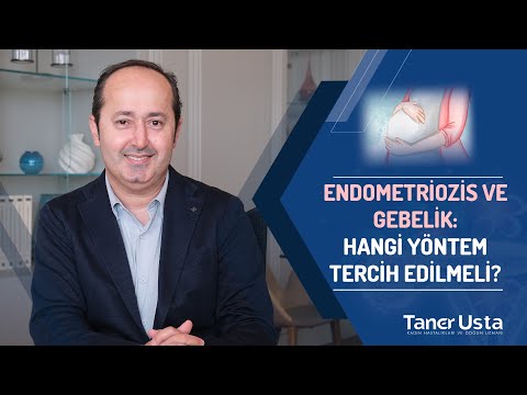 Endometrioziste Gebelik İstemi: Hangi Yöntem Tercih Edilmeli?