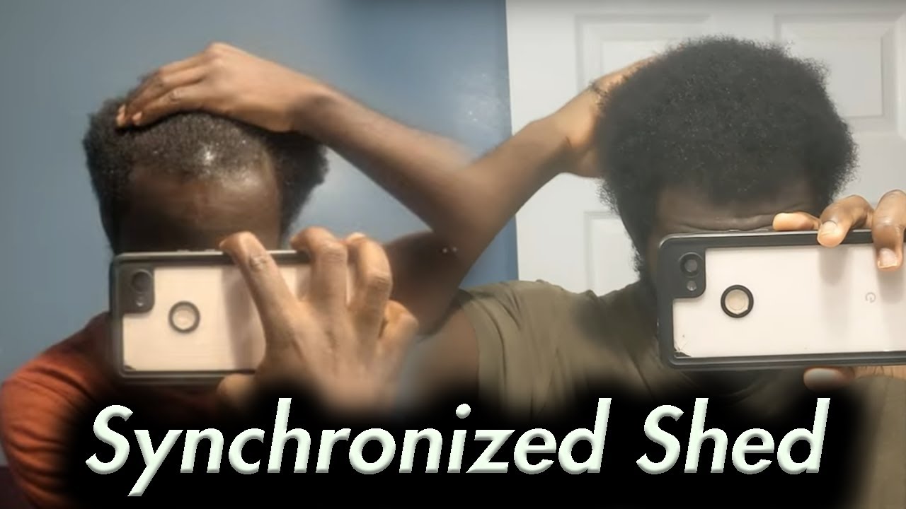 Финастерид и синхронизированное выпадение волос: 3–5 лет до ДЕЙСТВИТЕЛЬНОГО эффекта