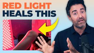 Top 5 Surprising Red Light Benefits You Didn’t Know