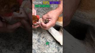 Ranking Top 5 Tick Removal