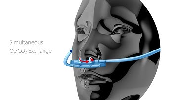 SunMed VentFLO EtCO2 Sampling Cannula Product Introduction