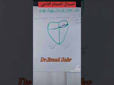 انسدال الصمام التاجي شرح مبسط