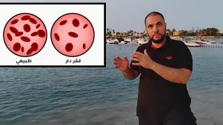 ازاي تعرف ان عندك انيميا وفقر الدم من غير تحاليل والحل والعلاج