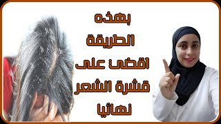 ما هو افضل علاج لقشرة الشعر علاج قشرة الشعر والحكة والتساقط بخطة علاجية تعمل على علاج القشرة نهائيا