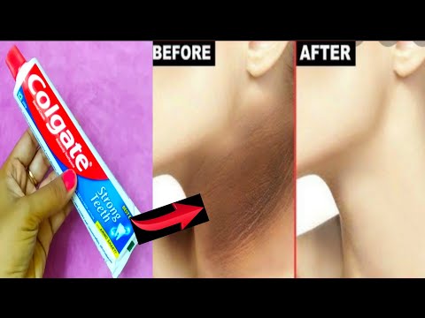 How to get rid dark neck in a few minutes | Toothpaste neck cleaning | neck black remove tips