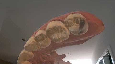 CEREC Scan in Hololens 2