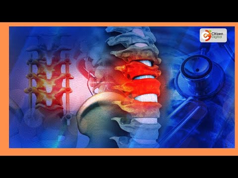 JUKWAA LA AFYA Kasoro Ya Uti Wa Mgongo Part 1 