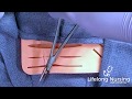 Basic Suturing: How to Suture