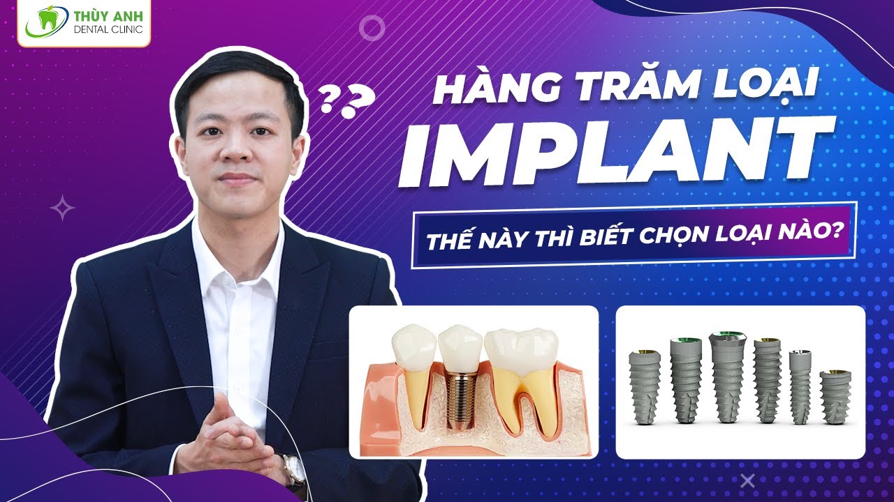 Outline Video Tại sao có nhiều loại Implant với nhiều mức giá khác nhau
