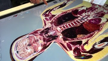 Anatomage and the Virtual Cadaver