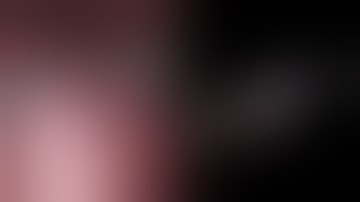 Binary segmentation of surgical endoscopic tools