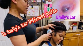 Checked My Hearing Impaired Daughter’s Ears With ScopeAround Autoscope