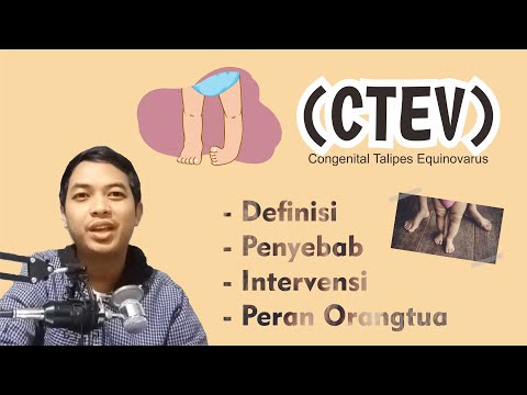 Video: Mengapa talipes equinovarus terjadi?