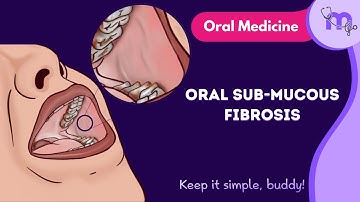 Oral Submucous Fibrosis | Full Video | Oral Medicine | Medi Study Go