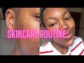 Skincare routine for acne breakouts  isabella garcia skin products review