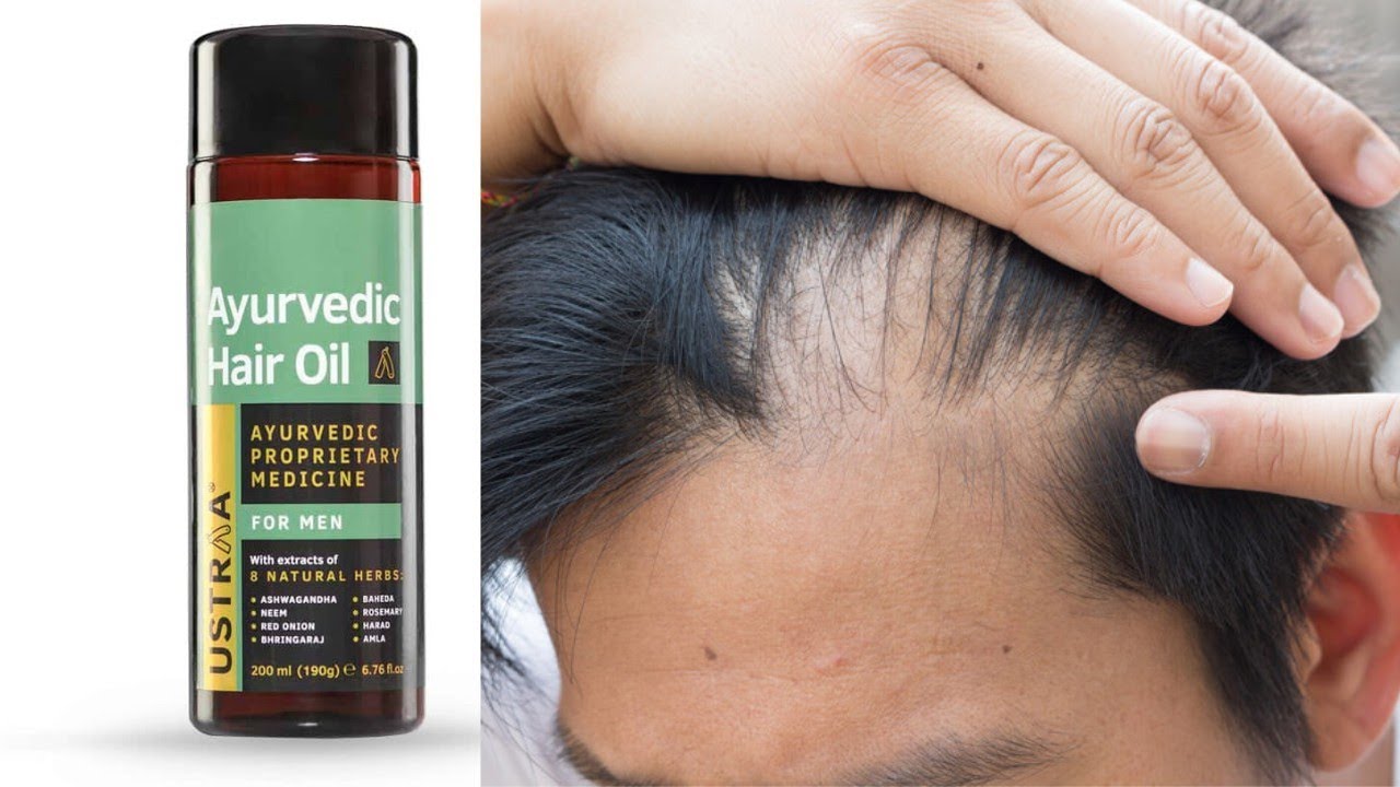USTRAA AYURVEDIC HAIR OIL REVIEW 🔥🔥 BEST HAIR OIL FOR MEN
