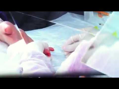 მოსახლეობის ნებაყოფლობითი C ჰეპატიტის უფასო სკრინინგი