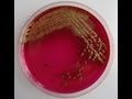 Maintenance and Storage of DH5 alpha E.coli Cells - Amrita University