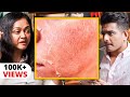 CELEBRITY SKIN CARE Secret - &quot;Skin Peels&quot; Explained By Bollywood&#39;s Dermat Dr.Rashmi