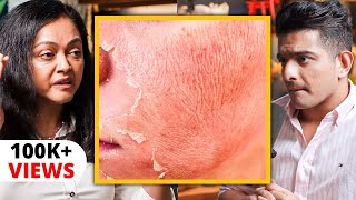 CELEBRITY SKIN CARE Secret  'Skin Peels' Explained By Bollywood's Dermat Dr.Rashmi