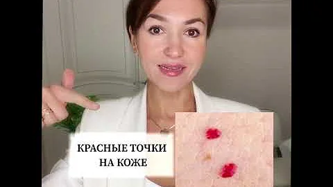 У ТЕБЯ ТАКИЕ КРАСНЫЕ ТОЧКИ НА КОЖЕ