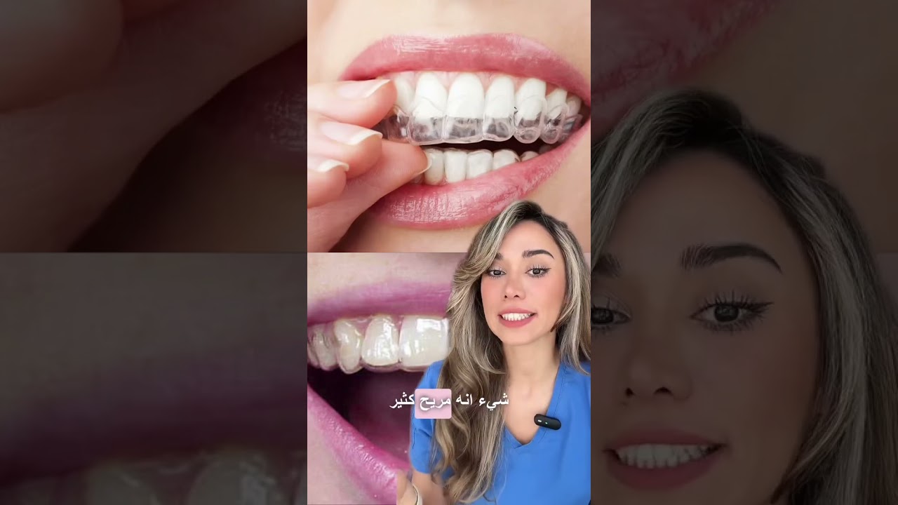 أي نوع من مثبت الأسنان ممكن تختار 🤔؟؟