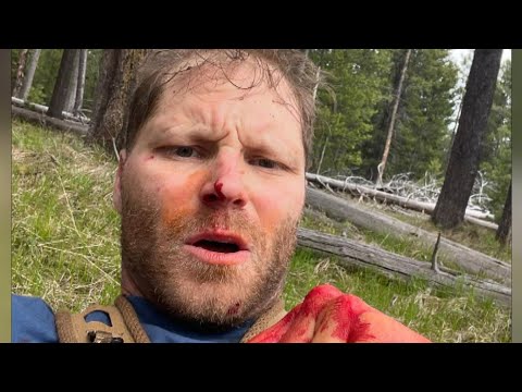 Army Vet Mauled by Grizzly Bear While on His Honeymoon