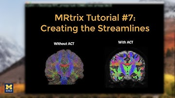 MRtrix Tutorial #7: Creating the Streamlines