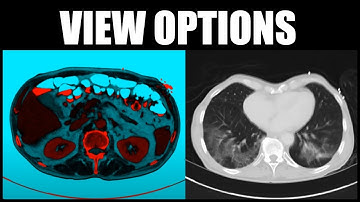 FireVoxel Tutorial 2: View Options