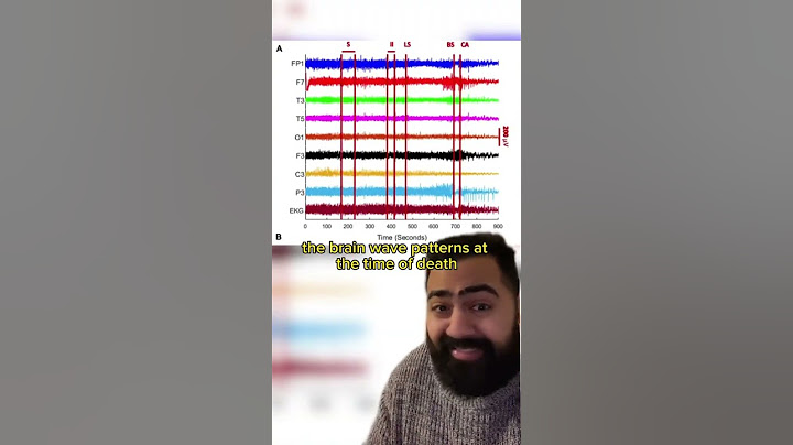 Doctor Explains What Happens After Death!