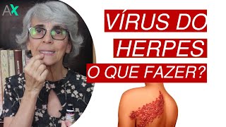 O que fazer com o vírus do herpes?